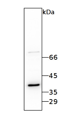 western blot using anti-RBP40 / 38 kDa RNA-binding Protein antibodies